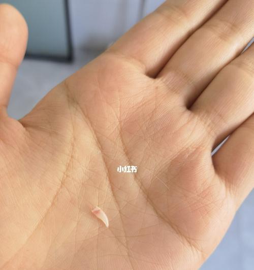 小猫换牙期的咬人行为与解决方法（宠物猫咪换牙期的注意事项和建议）