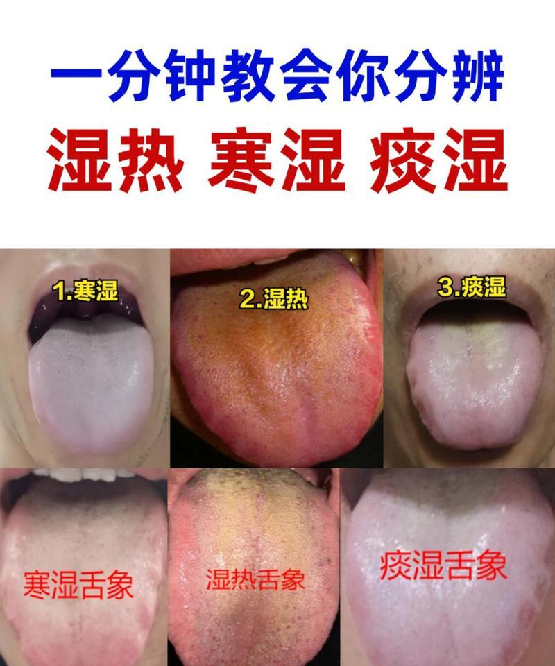 舌头白色（探索舌头白色的病因及治疗方法）