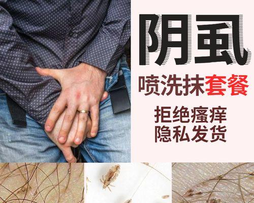 牛身上有虱子的治疗方法（有效消灭牛身上虱子的技巧与注意事项）