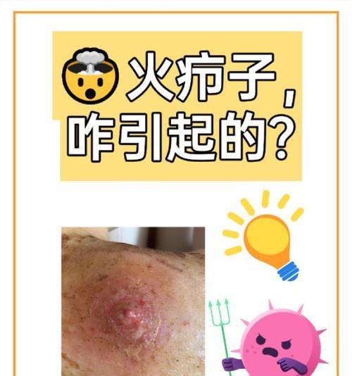探索传染人的皮肤病